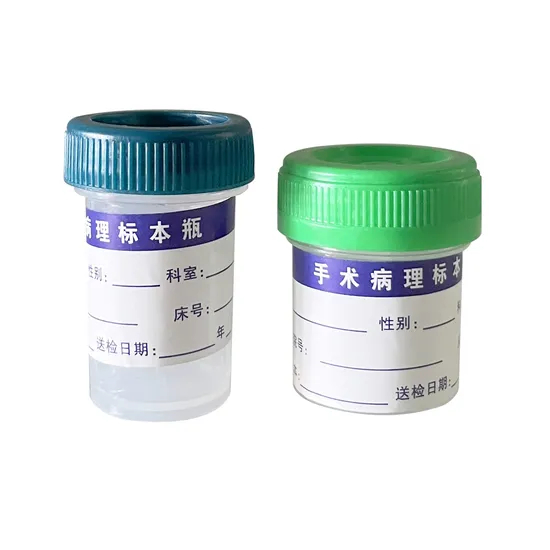 工厂直接销售塑料样品样品容器瓶，用于收集尿液